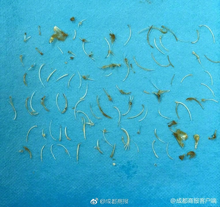 一張回國機票賺7萬 別任由“黑票代”趁疫打劫